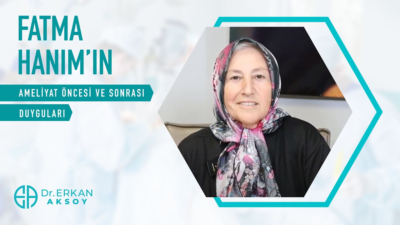 Fatma Hanim | I Had Mini Gastric Bypass Surgery